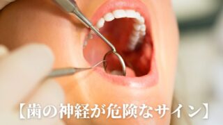 歯の神経があぶないサインとは？｜香川県高松市の歯科医院